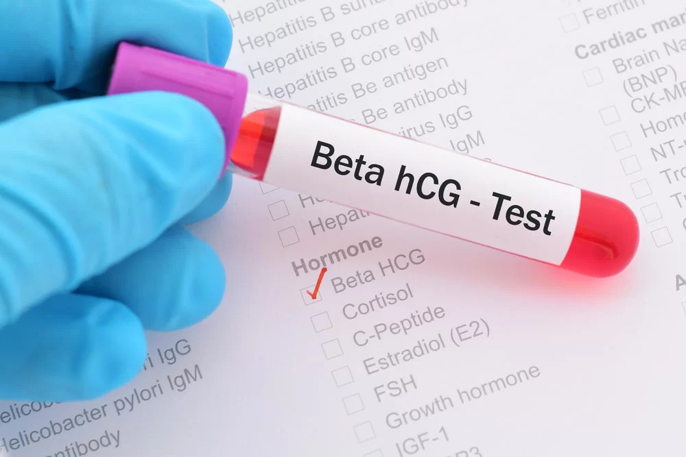 beta hcg positivo pdf para editar